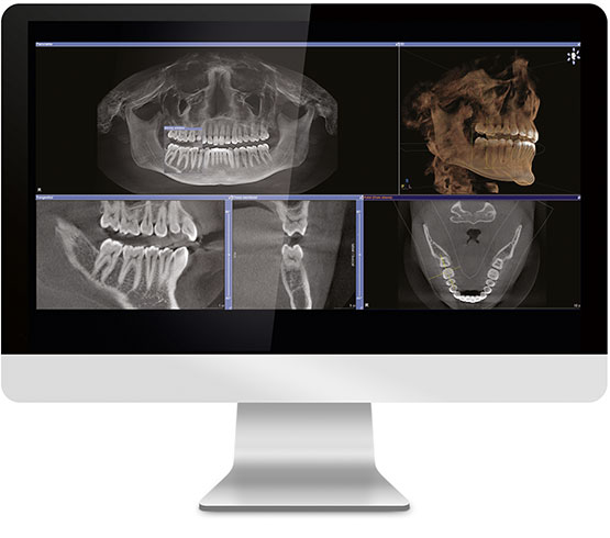 3D Imaging